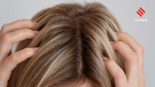 Why Your Scalp Itches in Winter and How to Fix It