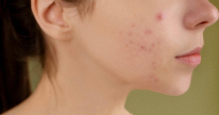 Why eat carrots in winter