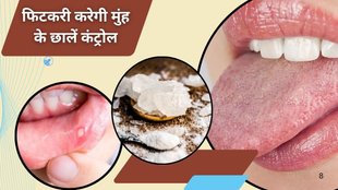 Alum water to get rid of mouth ulcers, muh ke chhalo ka gharelu ilaj, मुंह के छालों का घरेलू इलाज,Mouth ulcers, Mouth ulcer treatment