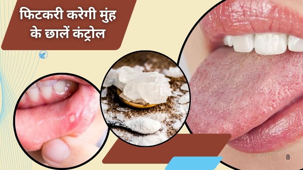 Alum water to get rid of mouth ulcers, muh ke chhalo ka gharelu ilaj, मुंह के छालों का घरेलू इलाज,Mouth ulcers, Mouth ulcer treatment
