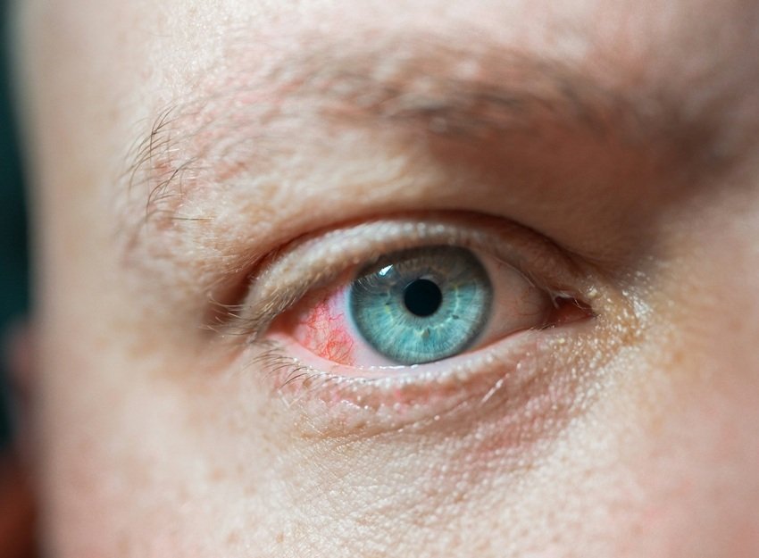 beauty tips for eyes