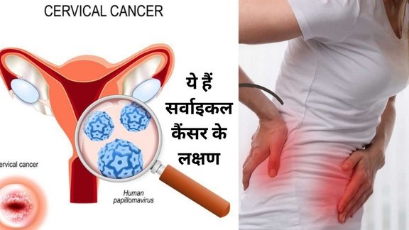 cervical cancer symptoms,early signs of cervical cancer,cervical cancer awareness,World Cervical Cancer Elimination Day,HPV vaccine,cervical cancer prevention,