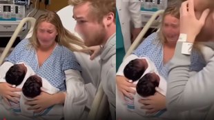 dark skinned twins viral video