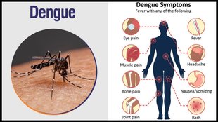 dengue fever, dengue symptoms , dengue prevention tips, dengue fever explains