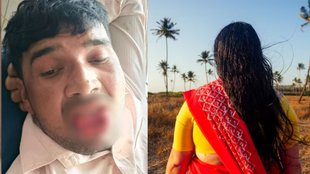 Woman, bite, tongue, Kanpur sexual assault case,