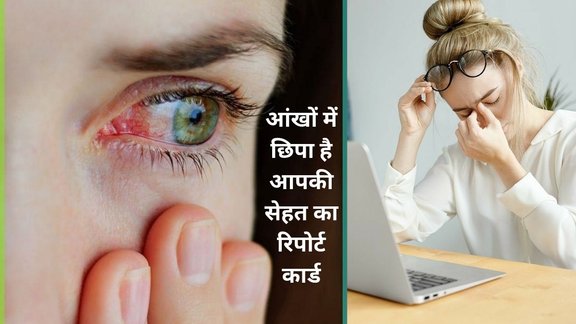 eye health signs, diseases shown in eyes, what eyes reveal about health, early signs in eyes, eye symptoms and diseases, diet for healthy eyes, vitamin deficiency in eyes,
