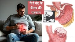 Stomach Cancer: खाने के बाद पेट में दर्द या मतली होना पेट के कैंसर के हो सकते हैं शुरुआती संकेत, Gastric Cancer के इन लक्षणों को तुरंत समझें, बच सकती है जान