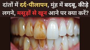 Home and Natural Remedies for Toothache Pain | Yellow teeth bad breath and gum bleeding | how to stop tooth pain fast