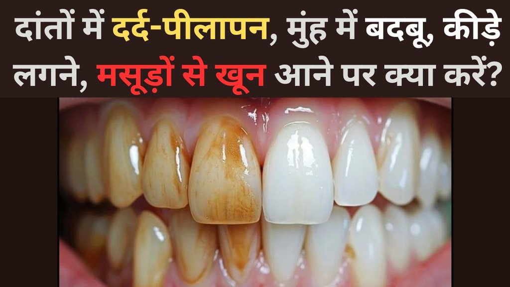 Home and Natural Remedies for Toothache Pain | Yellow teeth bad breath and gum bleeding | how to stop tooth pain fast