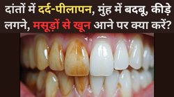 दांतों में दर्द-पीलापन, मुंह से बदबू या मसूड़ों से खून आने, कीड़े लगने पर अपनाएं ये घरेलू उपाय, मिलेगी राहत