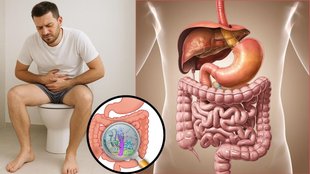 ayurvedic leaves for detox, herbs for stomach cleaning, natural remedies for constipation, dr vimal jhad ayurvedic tips, herbal remedy for gut health,