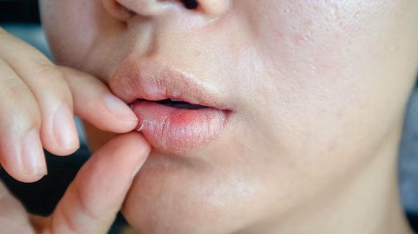 mustard oil for dry lips