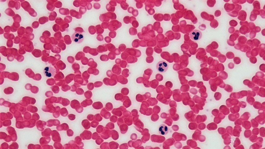 pale skin anemia