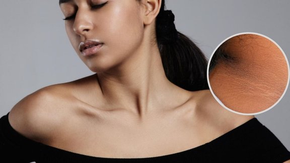 remove dark spots from your neck, neck dark spots, gardan ka kalapan, gardan ka kalapan kaise hataye