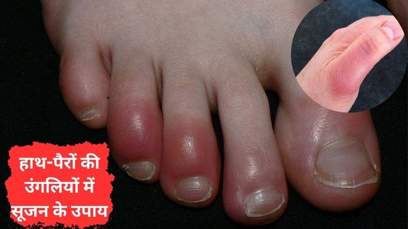 sardi me ungli sujan ka ilaj | pair ki ungli me sujan | Home remedies for swollen fingers and toe