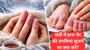 ungli sujan par kya kare | per ki ungli me sujan ka ilaj | hath ki ungli me sujan ka ilaj