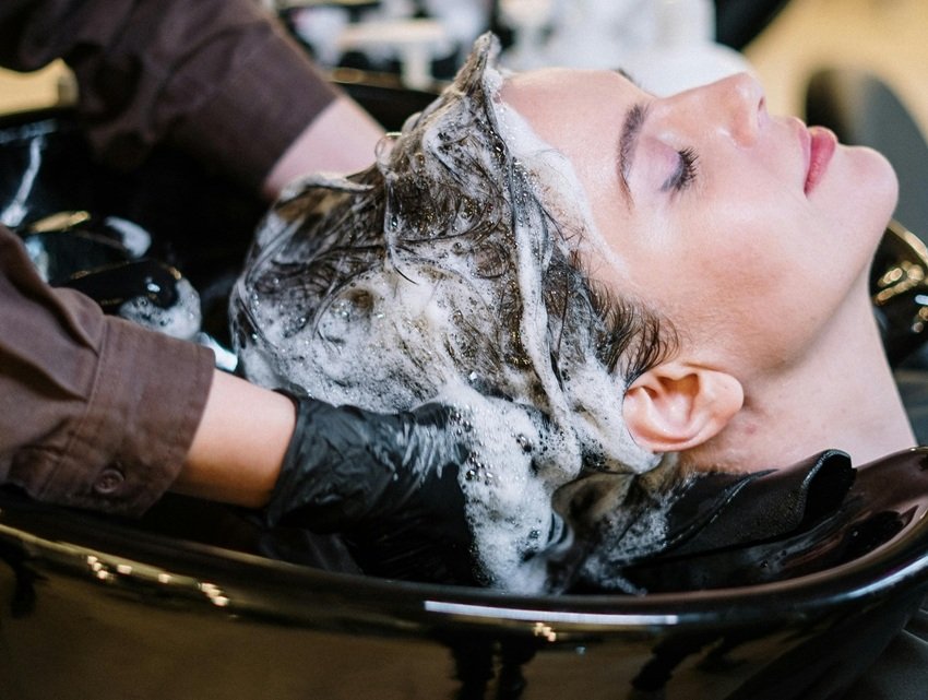 winter dandruff treatment