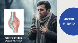 Asthma in winter, Winter asthma triggers, Cold weather asthma symptoms, Asthma flare-ups in winter, Breathing problems in asthma, Cold air and asthma, Asthma prevention tips winter