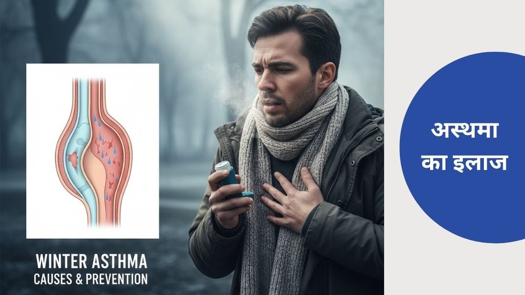 Asthma in winter, Winter asthma triggers, Cold weather asthma symptoms, Asthma flare-ups in winter, Breathing problems in asthma, Cold air and asthma, Asthma prevention tips winter