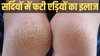 Cracked Heels Remedies: सर्दियों में फट रही हैं एड़ियां? इन घरेलू उपायों से स्किन होगी एकदम मुलायम