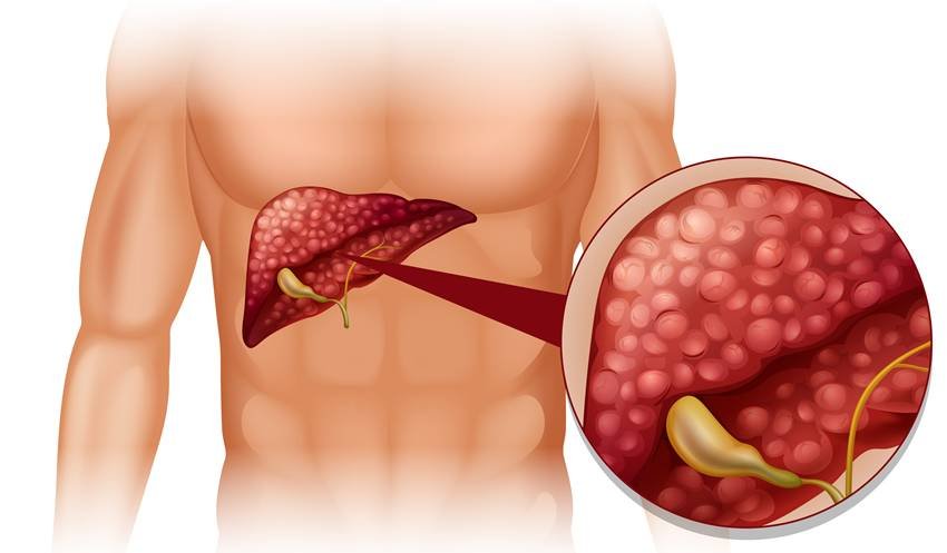 warm lemon water benefits