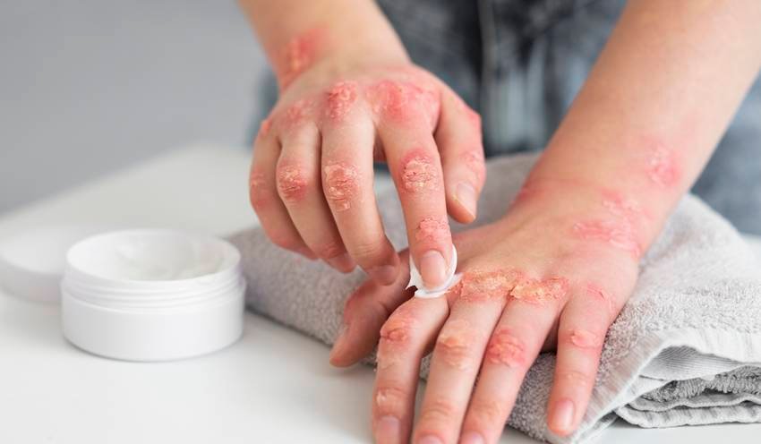 liver health symptoms