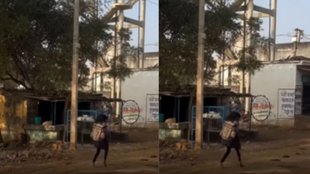 Young Schoolgirl With Prosthetic Legs Attends Classes Daily Emotional Video Goes Viral