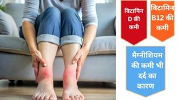 सर्दी में सुबह उठते ही पैर में दर्द, भारीपन और जकड़न रहती है? 3 विटामिन की कमी हो सकती हैं जिम्मेदार, खास तरीकों से करें स्टिफनेस का इलाज