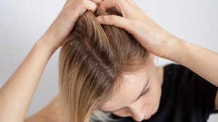 Home Remedies for Dandruff, Dandruff and Itchy Scalp, rusi se chutkara pane ke upay