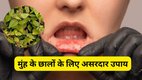 Mouth Ulcer Remedies, muh ke chhale ka ilaj, chirchita ke patte ke fayde, muh ke chhale turant kaise theek kare, muh ke chhale gharelu upay, mouth ulcers home remedy hindi, chirchita patte ayurvedic fayde, danton ka peelapan ka ilaj, oral health tips hindi, chirchita ke patte se munh ke chhale, chirchita se dant safed kaise kare, mouth ulcer causes hindi, ayurvedic remedy for mouth ulcers, natural teeth whitening hindi, ayurvedic tips for oral care, how to heal mouth ulcers quickly, what deficiency causes mouth ulcers, how to cure mouth ulcer in one day, how to cure mouth ulcers fast naturally