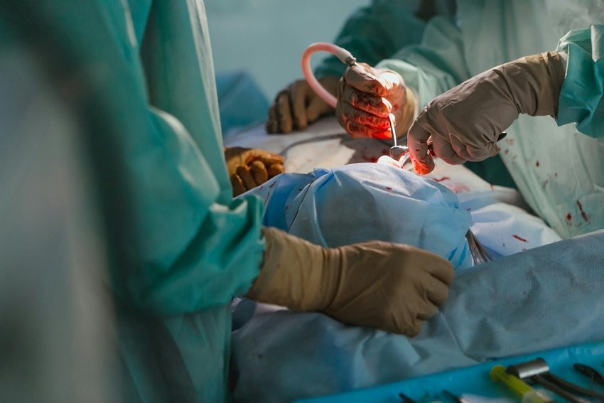 Organs That Can Save Lives Through Transplant