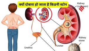 prevent recurring kidney stones
