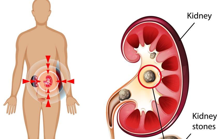 sarson ka saag benefits