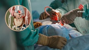 These Organs Can Give Someone a Second Chance at Life