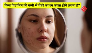 Vitamin deficiency causing skin darkening