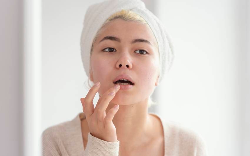 Vitamin remedy for dry lips