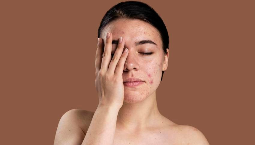 ghee consumption warning