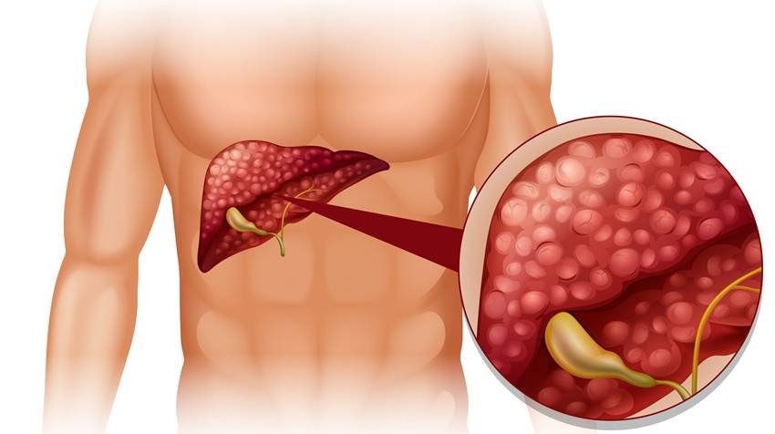 Ghee and health issues