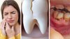 दांतों के दर्द, पीलापन, मसूड़ों से खून आना और बदबू जैसी समस्याओं को दूर करने के लिए आसान घरेलू उपाय