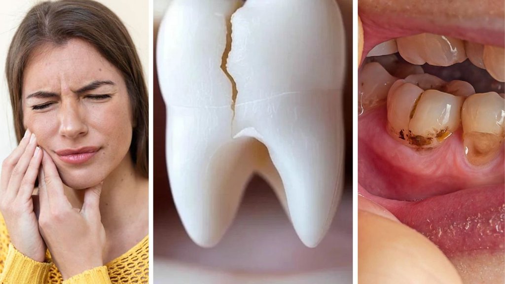 Home and Natural Remedies for Toothache Pain | Yellow teeth bad breath and gum bleeding | how to stop tooth pain fast