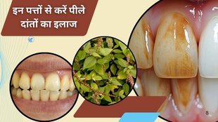 yellow teeth home remedy, bleeding gums treatment naturally, bad breath ayurvedic remedy, mouth infection herbal cure, apmarg leaf benefits, apamarga medicinal plant uses