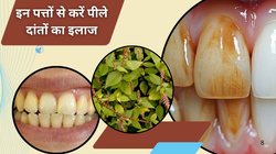 सिगरेट और पान खाने से दांतों का रंग पड़ गया पीला, ये हर्बल पत्ता करेंगा दांतों की सड़न और मूसड़ों का इलाज, डॉक्टर ने बताया मोतियों की तरह चमकेंगे दांत