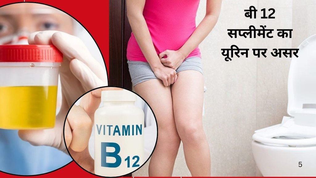 Vitamin B12 urine changes, Bright yellow urine after B vitamins, Neon yellow pee supplements, Water soluble vitamins urine color, B-complex side effects urine Vitamin B12 urine changes, Bright yellow urine after B vitamins, Neon yellow pee supplements, Water soluble vitamins urine color, B-complex side effects urine
