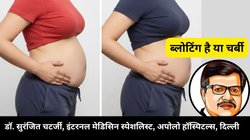 पेट निकल रहा है या सिर्फ गैस भरी है? कैसे पहचानें ‘Belly Fat’ और ‘Bloating’ के बीच का अंतर, डॉक्टर ने बताया