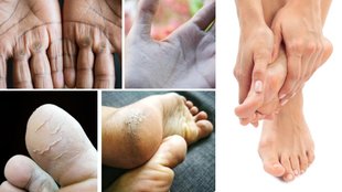 Winter Skincare Tips | Fati Hui Skin Par Kya Lagaye | How to heal cracked hands feet and heels