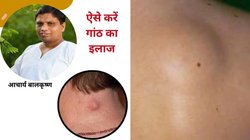 Lipoma Treatment: बिना सर्जरी गल जाएगी शरीर की हर गांठ! आचार्य बालकृष्ण ने बताया सदियों पुराना घरेलू नुस्खा, बस 1 जड़ी-बूटी में है जादुई असर