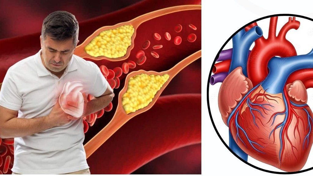 Heart Blockage, Coronary Artery Disease, Heart Attack Risk, Blood Flow to Heart, Causes of Heart Blockage, Heart Blockage Treatment,Cardiac Health Heart Blockage, Coronary Artery Disease, Heart Attack Risk, Blood Flow to Heart, Causes of Heart Blockage, Heart Blockage Treatment,Cardiac Health