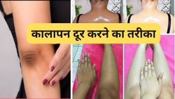 कैसा भी कालापन हो धीरे-धीरे होने लगेगा साफ… अपनाएं ये घरेलू उपाय, घुटने से लेकर कोहनी तक से हटेगी गदंगी