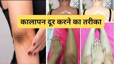कैसा भी कालापन हो धीरे-धीरे होने लगेगा साफ… अपनाएं ये घरेलू उपाय