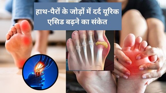 Uric Acid Levels, Causes of High Uric Acid, Hyperuricemia,Gout Causes, Uric Acid and Kidney Health,Purine Rich Foods,